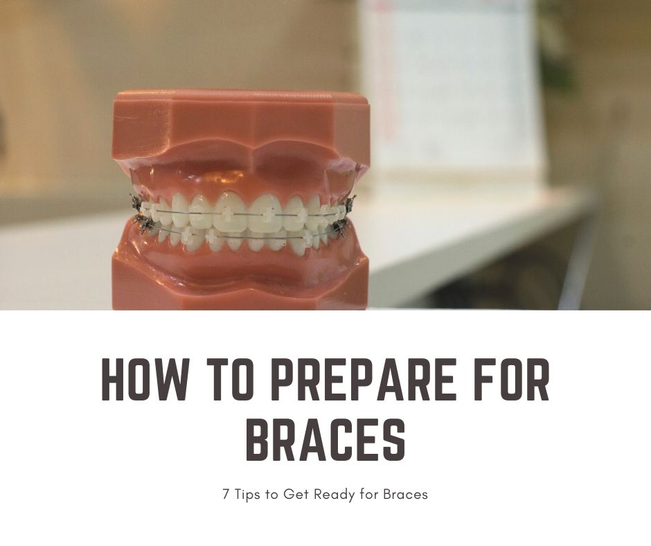 how to prepare for braces